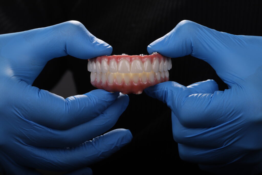 Manutenção e Higiene de Próteses Protocolo e Implantes Dentários